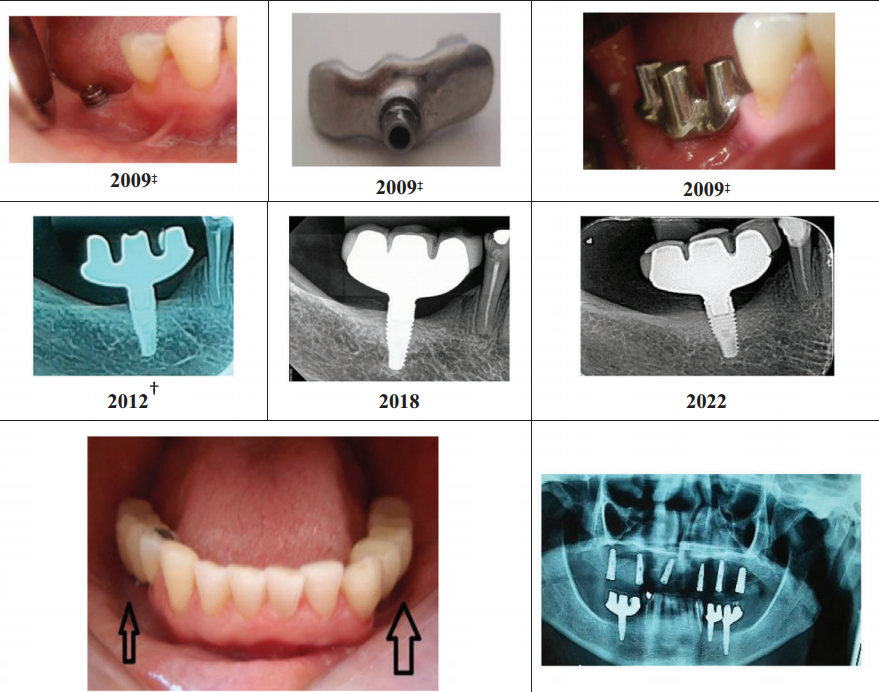 Dr. Luciana has been working with her team for more than 12 years to prove her BoPIT concept
